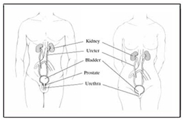 Cystoscopy Ureteroscopy India Surgery offers info on Cost Ureteroscopy Surgery India, Cystoscopy India, Ureteroscopy Surgery India