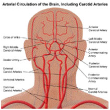 Atherosclerotic Disease Of The Carotid Artery Treatment India offers info on Atherosclerotic Disease Of The Carotid Artery India