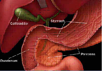 Pancreatic Cancer Research India, Pancreas Tumor India, Pancreatic Cancer Treatment India