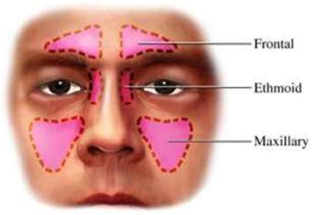 Sinus Surgery, Sinus, Nose, Sinus Surgery India, Sinus Surgery Symptoms, Sinus Infection, Sinusitis, Sinus Headache