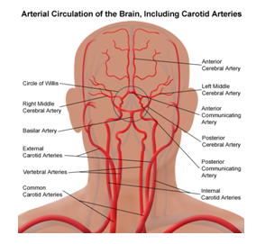 Vascular Surgeon, Carotid Endarterectomy