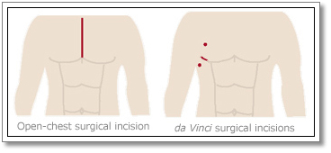 Heart Surgery India, Stem Cell Technologies, Open Surgery, Adrenals