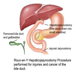 India Liver Disease, Endoscopy India, Gastroenterology India
