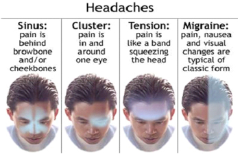 Headache Migraine Treatment India Offers info on Headache & Migraine Clinic India, India, Headache Clinic India, Headache Clinic India, Headache & Migraine Centre India