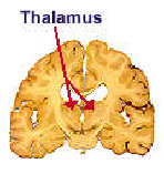 halamotomy Surgery India Offers info on Thalamotomy India, Thalamotomy Surgery India, Brain And Nerves India