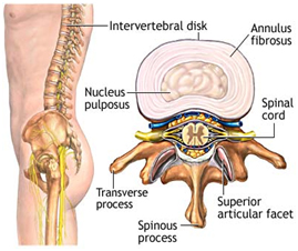 Back Pain Surgery, Back Pain Surgery India, Neck Pain, Spinal Pain, Back Strain