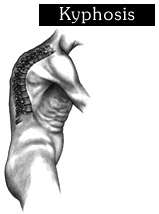 India Spine Anatomy, Cervical