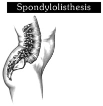 India Spine Anatomy, Spine