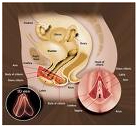 Clitoral Hood Reduction Surgery, Clitoropexy, Clitoral Hood Removal Surgery