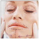 Cosmetic Surgery, Corrective Cosmetic, Cosmetic, Cosmetic Procedures, Cosmetic Surgeon