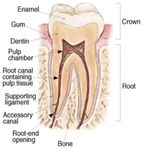 Root Canal Treatment India, Cost Root Canal Treatment Hospital India