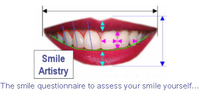 Smile Designing India, Cosmetic Smile Designing India, Cost Smile Design India, Smile Designing, Cosmetic Dentistry