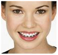 Orthodontists Dental Braces, Dental, Treatment, Invisible Braces, Dental Implants, Braces (Orthodontic Treatment) Services