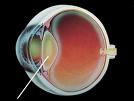 Cataract Surgery India, Cataract India, Cataract Surgery India, Cataract Surgery Information