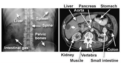 Computed Tomography India, Computed Tomography CT India, Body CT India, CAT Scan India, Medical Imaging India