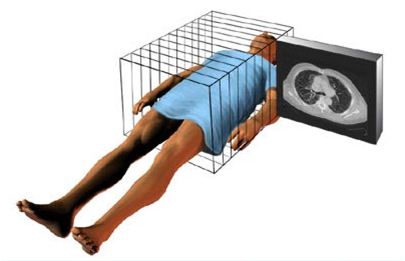 CT Scan offers info on CT  India, Computed Tomography CT  India, Body CT  India, CAT Scan  India, Tomography  India