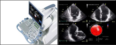 2D Echo  India, Echo Doppler  India, Color Doppler  India