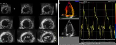 2D Colour Doppler offers info on 2D Echo Color Doppler  India, 2D Echo  India, Color Doppler  India