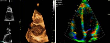 2D Colour Doppler offers info on 2D Echo Color Doppler  India, 2D Echo  India, Echo Doppler  India, Color Doppler  India