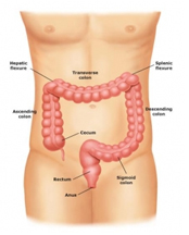  Hemicolectomy Right Surgery India, Right Colon Resection India, India Hospital Tour India