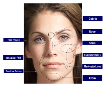 Fillers Treatment offers info on Filler India, Skin Filler Treatment India, Skin Fillers Cosmetic India, Fillers India