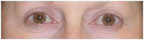 Permanent Makeup Treatment India offers info on Cost Permanent Makeup Treatment India