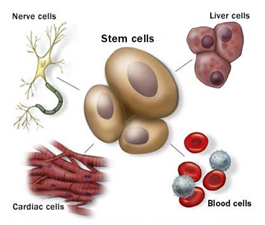 Stem Cell Therapy India offers info on India Stem Cell Therapy India, Low Cost Stem Cell Therapy India, Avascular Necrosis Stem Cell Therapy India