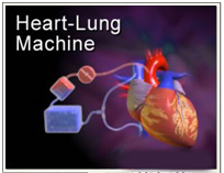 Heart Transplant Surgery India offers info on Cost Heart Transplant India, Best Price India Surgery Heart Transplant India